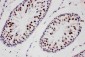 Anti-PIAS1 Antibody